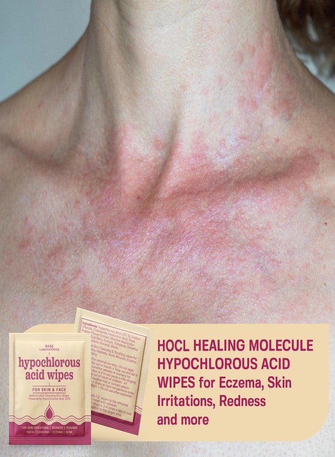 BASE LABORATORIES Hypochlorous Acid Wipes for Face & Skin - Facial Cleansing and Daily Skin Repair Hypochlorous Acid Wipes - for Sensitive Skin, Redness, Irritations, Eczema - 75 Wipes - Image 3